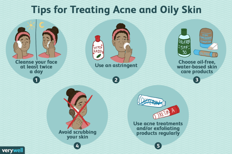 How to Take Care of Oily Skin